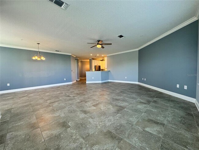 Building Photo - 3404 79th St W