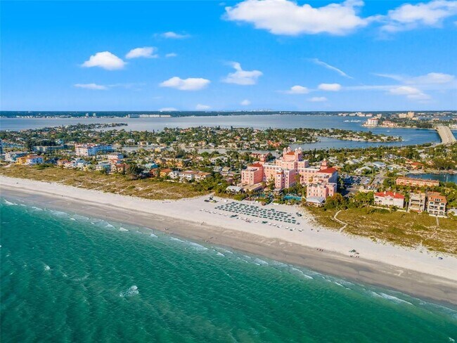 Building Photo - 301 87th Ave