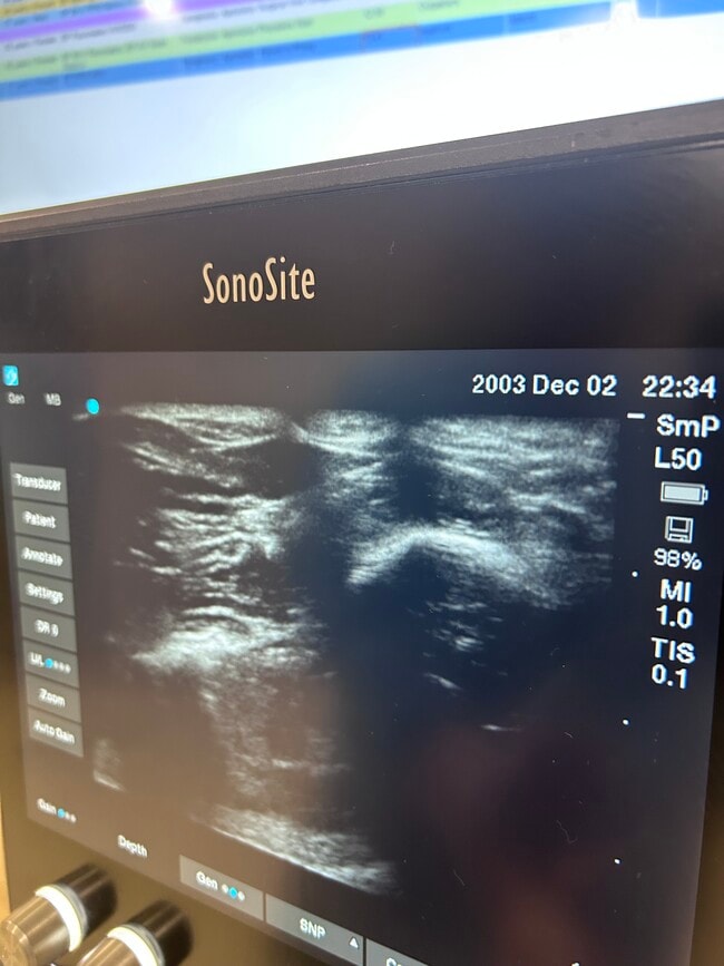 Building Photo - 15101 Callohan Ct