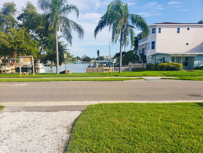 Building Photo - 178 175th Ave E